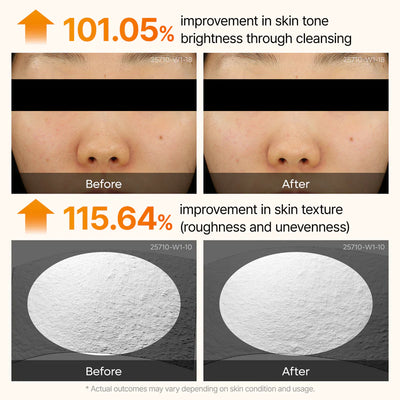 10-Step Skin Renewal Routine Set