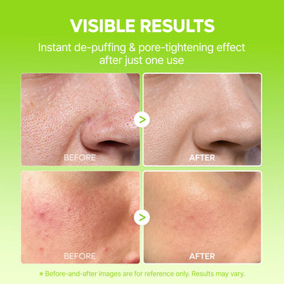 10-Step Skin Renewal Routine Set