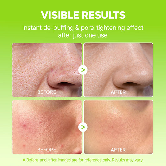 10-Step Skin Renewal Routine Set