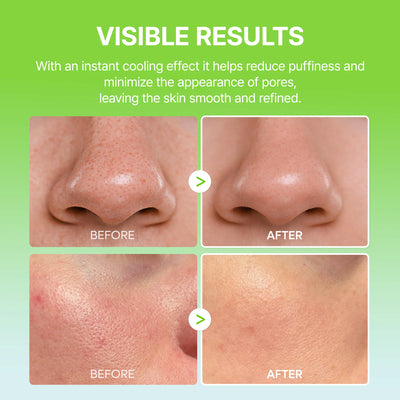10-Step Skin Renewal Routine Set