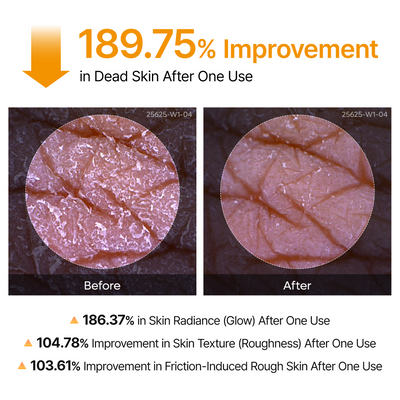 Peel Shot Complete Care Set